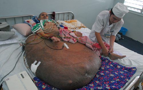 Preparing for surgery